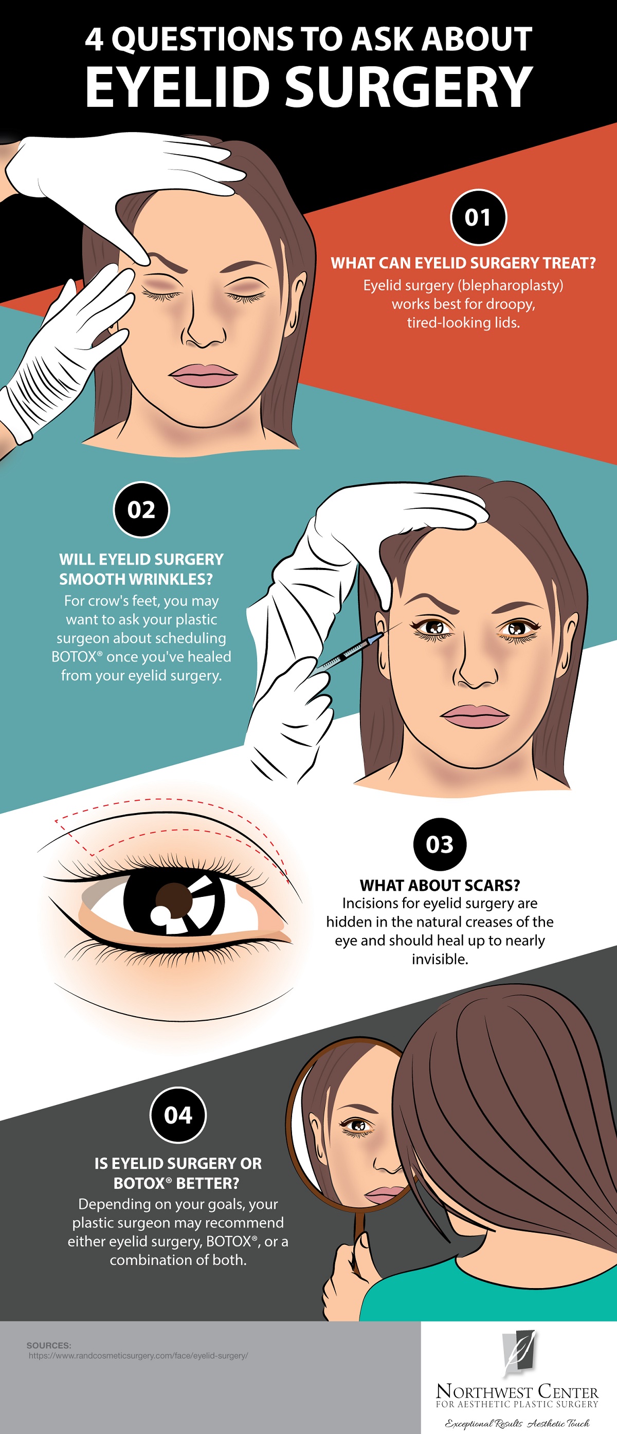 Questions To Ask About Your Eyelid Surgery